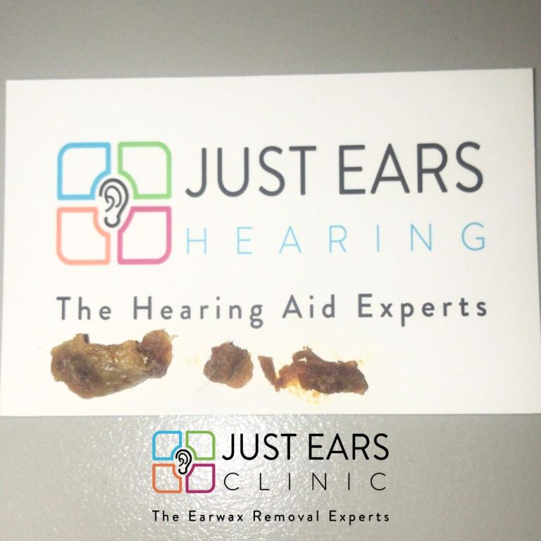 ear wax blog pic